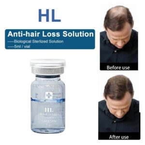 HL (anti-hair loss, hair regain)
