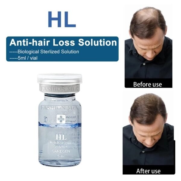 HL (anti-hair loss, hair regain)