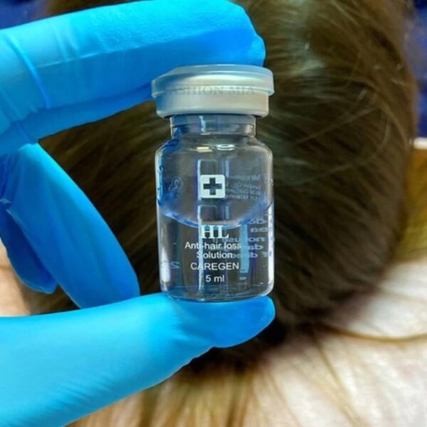 HL (anti-hair loss, hair regain) - Image 2